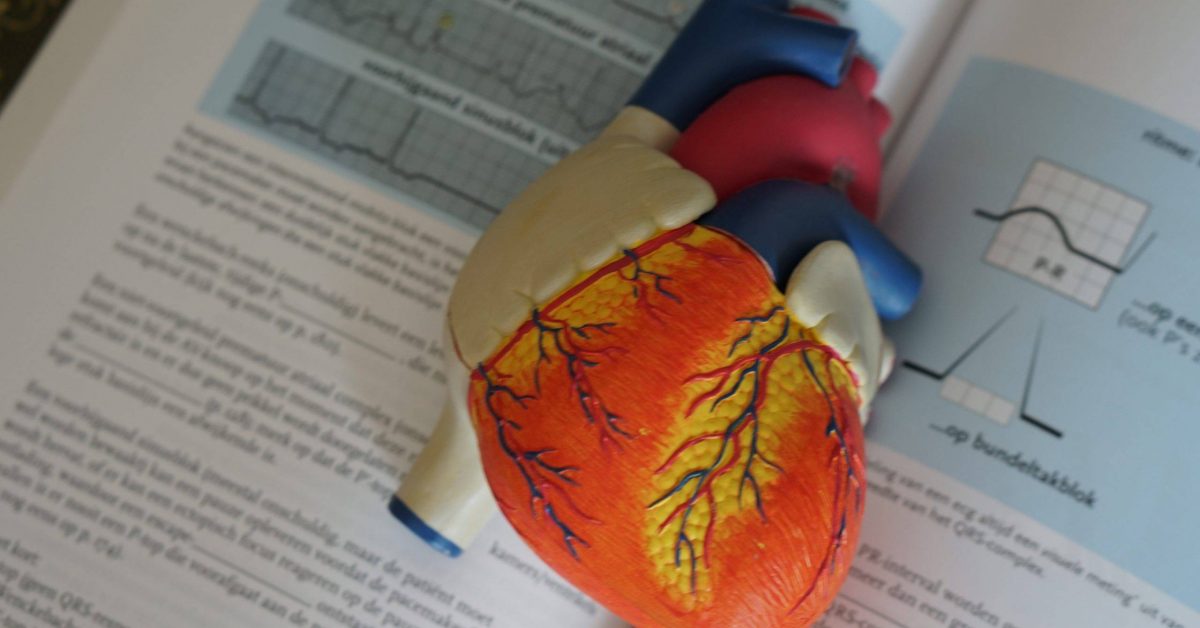 a Harry szív chrysalis egészsége rosszabb hipertónia hipotenzió